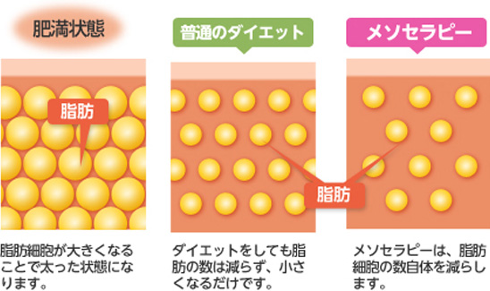 施術のイメージ